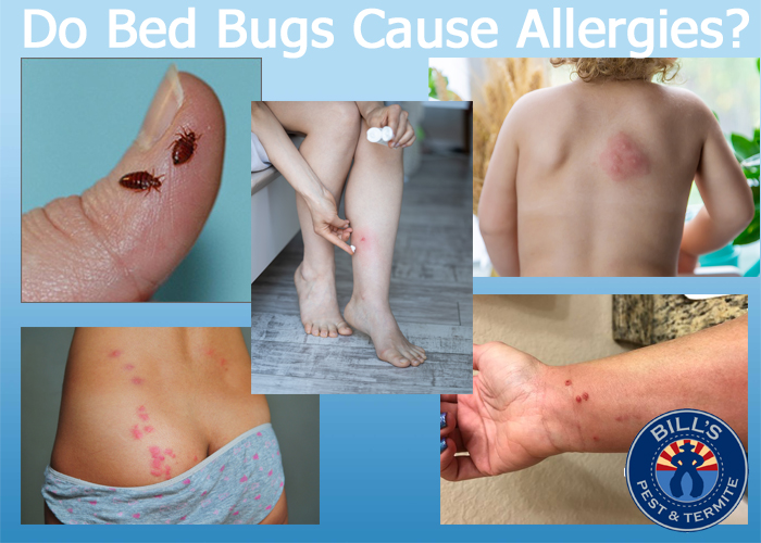 Do Bed Bugs Cause Allergies? Bills Pest Termite Control
